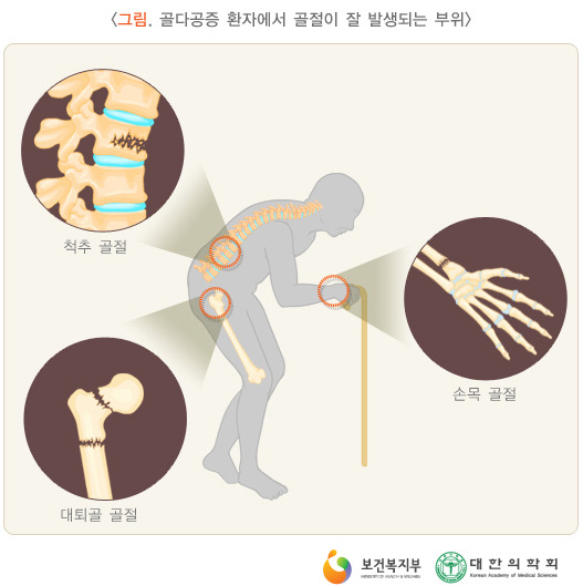파이토스테롤 Phytosterols : 네이버 블로그