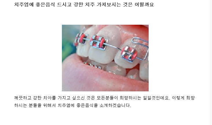 치주염에 좋은음식 드시고 강한 치주 가져보시는 것은 어떨까요
