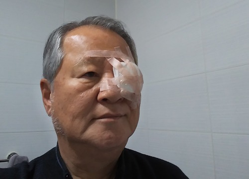 핀트가 안맞아(2)
